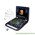 New general 4D laptop ultrasound