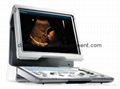 DP 50 Portable Ultrasound