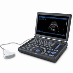 ultrasound scanner