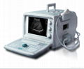 Ultrasound apparatus 1