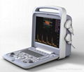 Color doppler ultrasound scanner 1