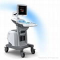 ultrasound apparatus