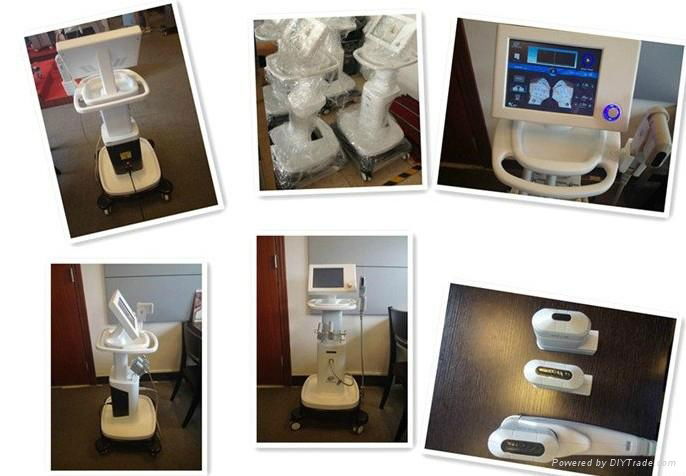 HIFU high intensity focused ultrasound hifu machine wrinkle removal system  4