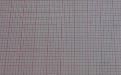 Twelve-Conduct Electrocardiograph Paper