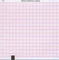 Three-Conduct Electrocardiograph Paper