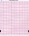 Three-Conduct Electrocardiograph Paper