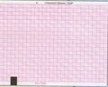 Six-Conduct Electrocardiograph Paper