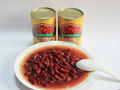 400g canned red kidney beans for