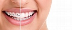 PlusDent Dental Products Supplier Co., Ltd
