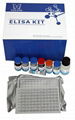 Human Tri-iodothyronine(T3) ELISA Kit 1