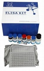 Human Tri-iodothyronine(T3) ELISA Kit