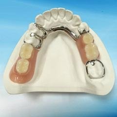 Dental Metal framework Partial dentures supplier
