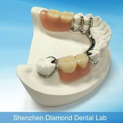 Dental CCP supplier Metal casting framework 