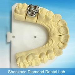 Dental Full metal crown/FCC Denture supplier 4