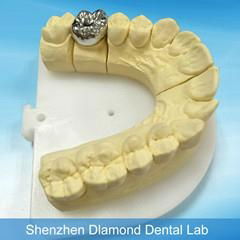 Dental Full metal crown/FCC Denture supplier 3