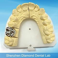 Dental Full metal crown/FCC Denture supplier