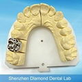 Dental Full metal crown/FCC Denture supplier