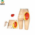 Advanced Medical Bottom Injection Model 2