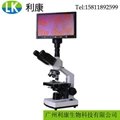 广州双目带屏幕显微镜一滴血检测仪高清 