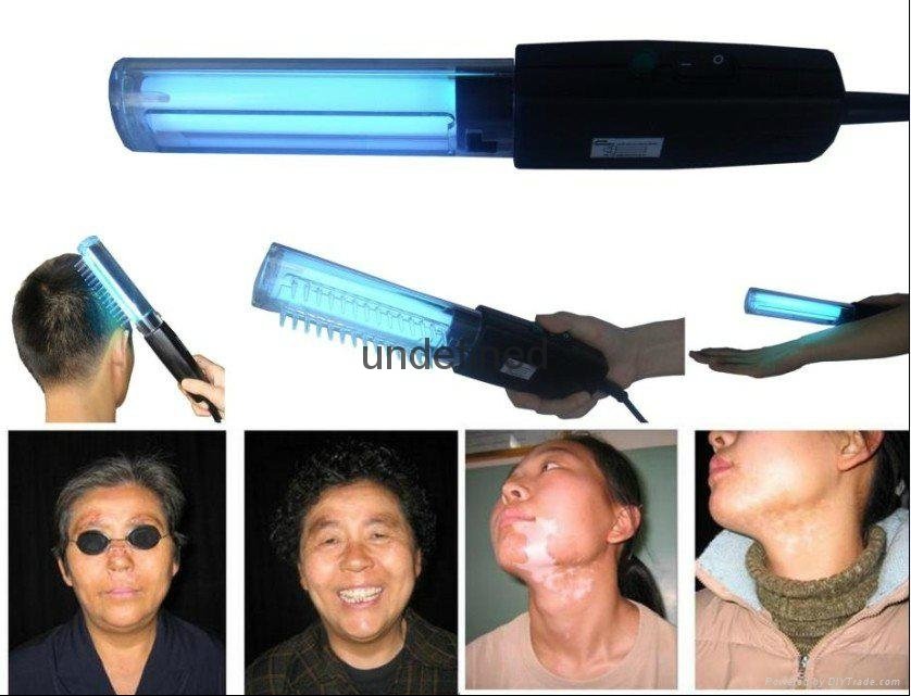 311nm narrow band uvb lamp for vitiligo treatment 4