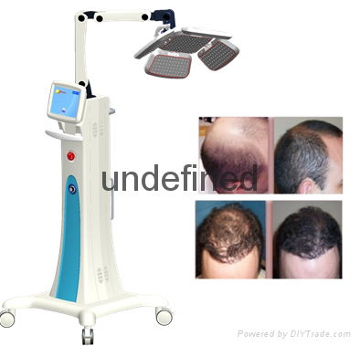 2015 newest 650nm hair restoration diode laser equipment for Androgenetic Alopec