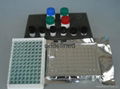 Rat malondialchehyche,MDA ELISA Kit