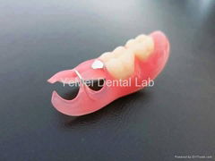 Vaplast denture