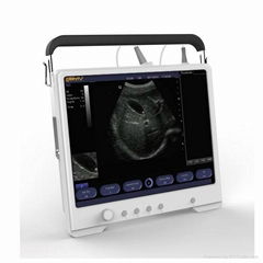 Full Touch Screen Tablet-based B/W Ultrasound System