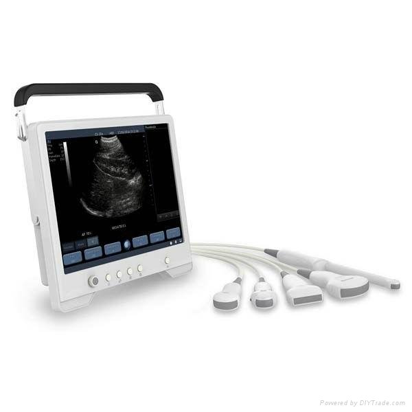 Full Touch Screen Tablet-based B/W Ultrasound System 2
