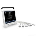 Full Touch Screen Tablet-based B/W Ultrasound System 2