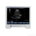 Full Touch Screen Tablet-based B/W Ultrasound System 3