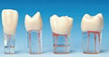 root canal model S12 1