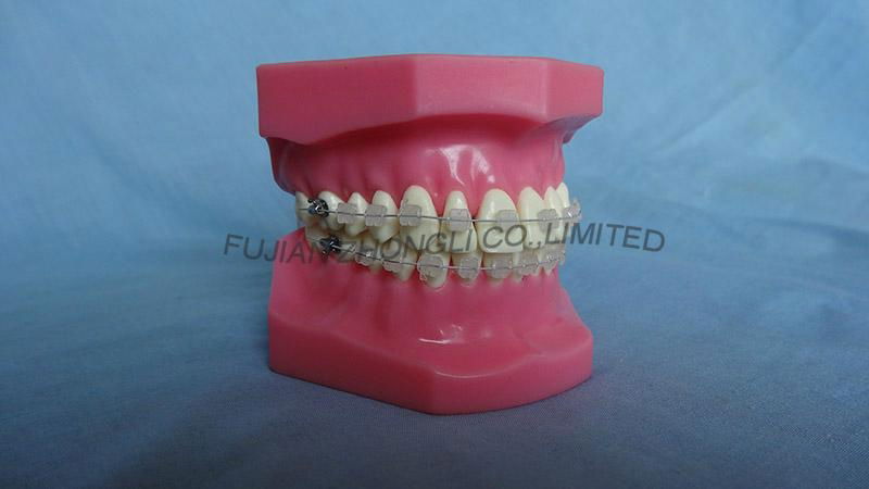 Orthodontic Teeth Model