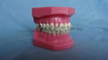 Orthodontic Teeth Model