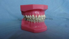 Orthodontic Teeth Model