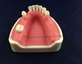 medical science dental implant model