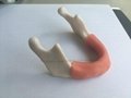 implants dental models with soft