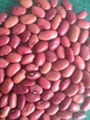 small red kidney beans 5