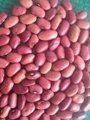 small red kidney beans 4