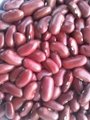 dark red kidney beans 5