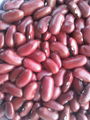 dark red kidney beans 3