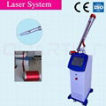 Q-Switched Nd: YAG Tattoo Removal Laser 4