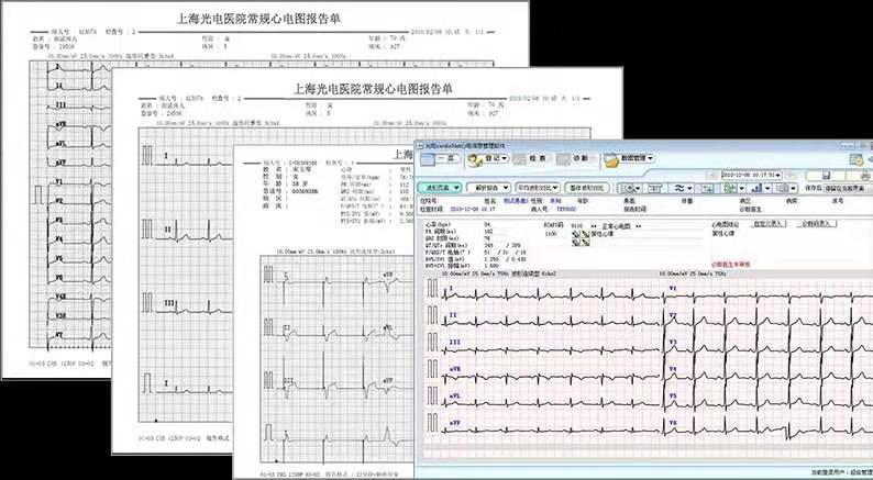 心电信息管理系统 3