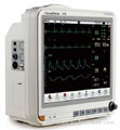 15 inch Patient Monitor with CE 1