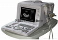 Protable Full Digital Ultrasound Scanner