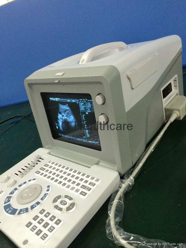 Protable Full Digital Ultrasound Scanner built-in battery 2