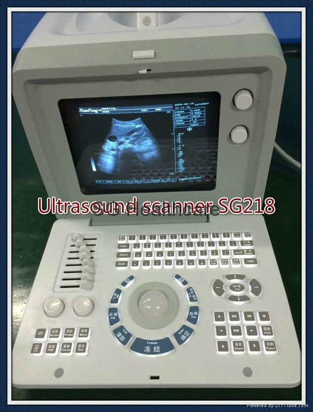 Protable Full Digital Ultrasound Scanner built-in battery 3