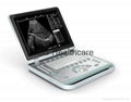 Portable 15 inch Laptop Ultrasound