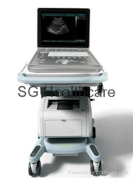 Portable 15 inch Laptop Ultrasound Scanner with 3.5MHz Convex Probe SG-S7 2