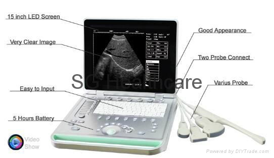 Portable 15 inch Laptop Ultrasound Scanner with 3.5MHz Convex Probe SG-S7 4